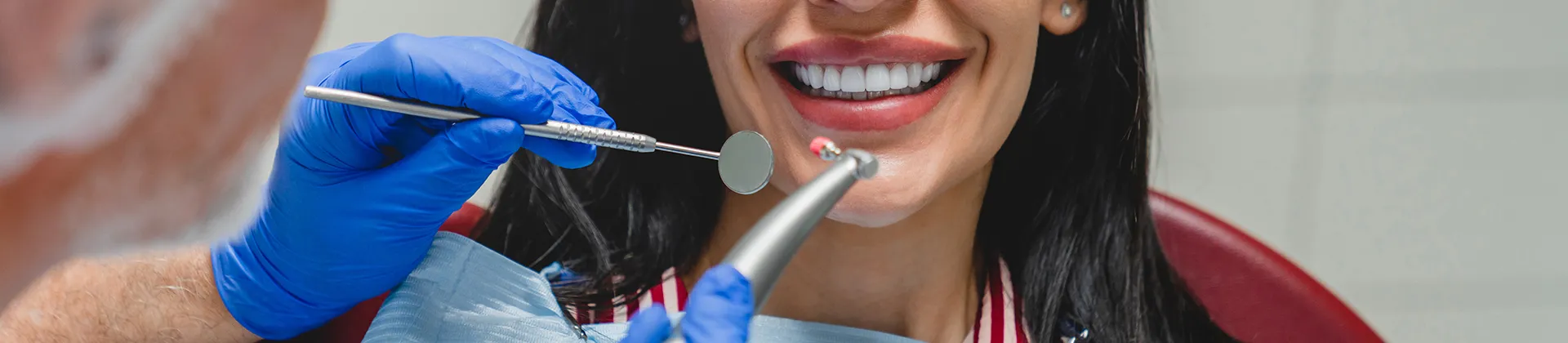 carillas dentales clinica dental barqueta